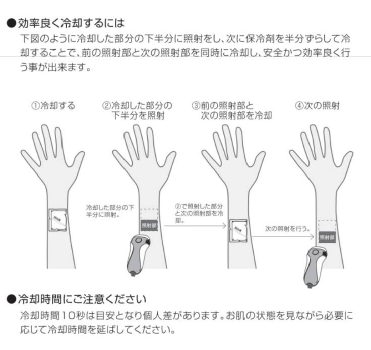 効率の良い照射